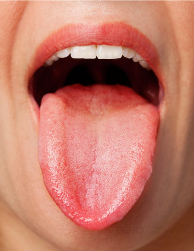 委托:寻求最健康的成人舌苔照片