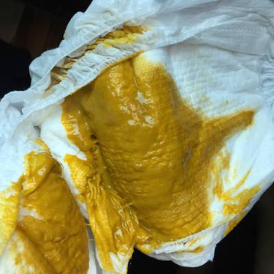 问答 婴儿期0-1岁  丫头94205个月29天2017-05-04 推荐回答