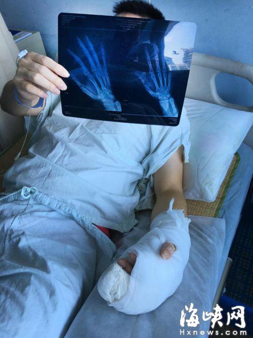 黑衣男凌晨入室盗窃 福州一租客勇擒贼手指被夹断