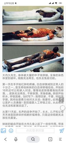 东海村核临界事故!