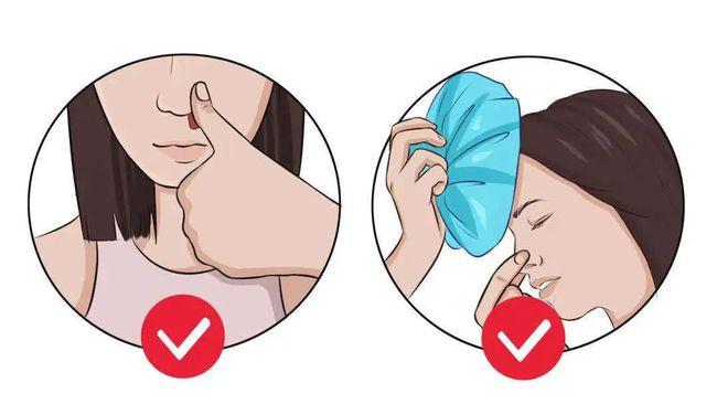 流鼻血|黏膜_网易订阅