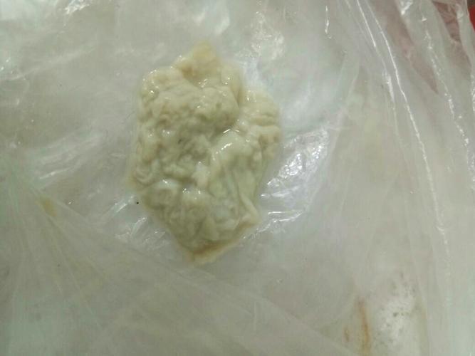 痒伴有好多白带,到药店买了冲洗液,冲洗了好多白带出来了,像豆腐渣一