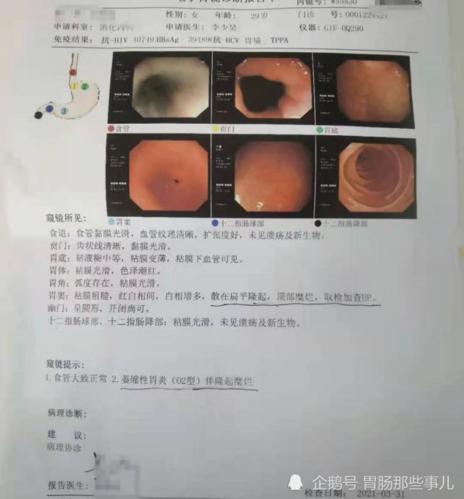 29岁查出萎缩性胃炎很担心会癌变吗如何科学防治
