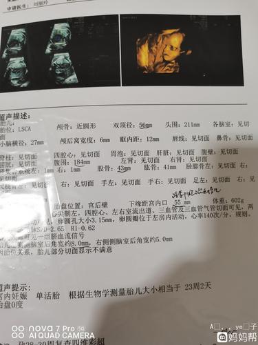 24周医生说胎儿横胎脐带绕颈一圈小了一个