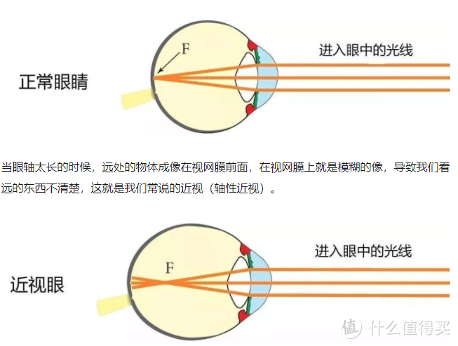 蔡司镜头不它还可以是镜片你可能忽略的儿童近视防控验光问题都在这里