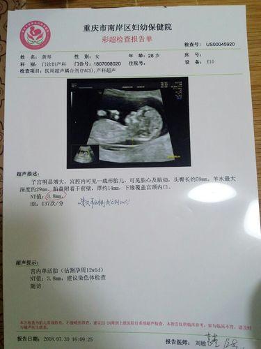 前天检查了nt3.8mm,孩子还能留住吗?真着急