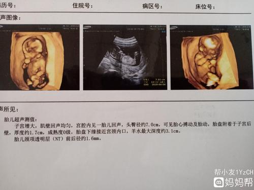 有没有会看nt的朋友啊?帮忙看看男孩女孩