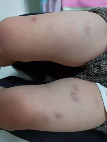 中国家长求助:"孩子在新加坡幼儿园被虐待,我该怎么办