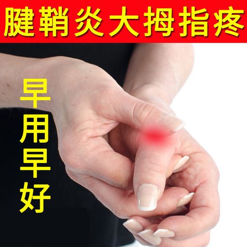 腱鞘炎贴手指大拇指关节疼痛麻木腱鞘炎大拇指手麻手
