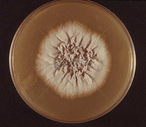 这张照片描绘了一个培养皿内其毛癣菌的真菌菌落癣菌变种的正面照.
