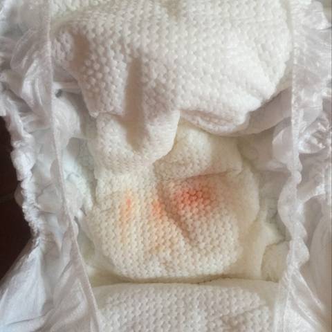 各位高手您好,男宝宝尿片上有一点粉红色的东西,是小鸡鸡接触尿片的