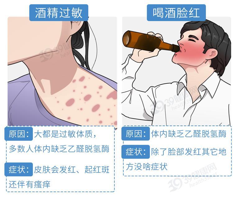 体内缺乏乙醛脱氢酶喝酒脸红主要是因为喝酒脸红喝酒后脸上的不同表现