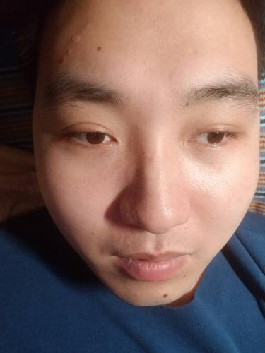 大家看看眼睛斜不?我感觉两个眼球不一样大,白眼球大小不一样.