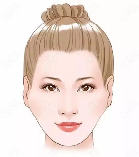 高颧骨脸颊过宽的菱形脸在南宁做颧骨内推一般需要多少钱