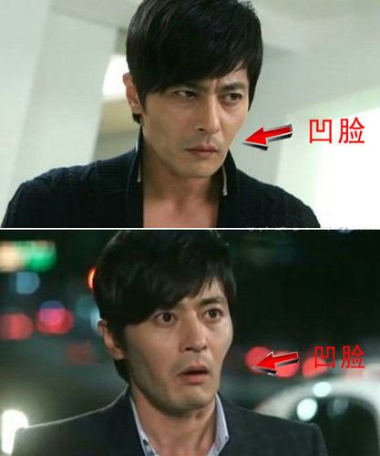 金南珠浮肿张东健脸凹韩星整容后遗症
