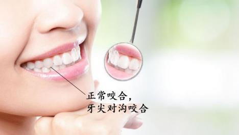 一般而言,正常的咬合关系是:上排牙齿的窝,对下排牙齿的尖,上排牙齿在