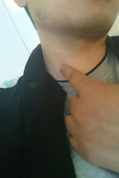 脖子这里长了个包,在里面,摸得到看不到.咽东西会疼.今天早上才疼的.