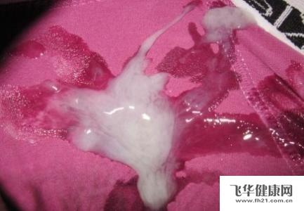 男精子不液化怎么办