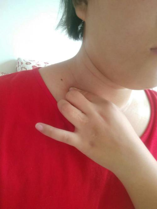 按压锁骨窝里的脖筋,副乳那里酸疼.