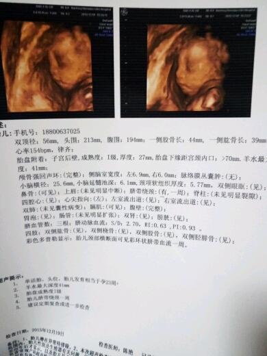 四维顺利通过.有接的吗.男宝一枚.