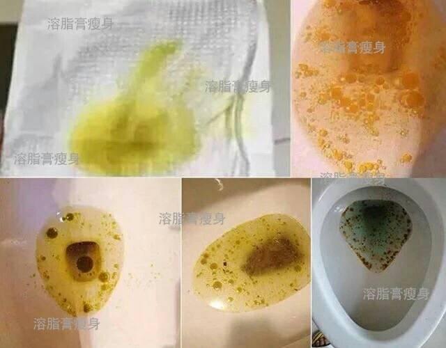 用这种方法减肥,排油脱脂瘦掉40斤!