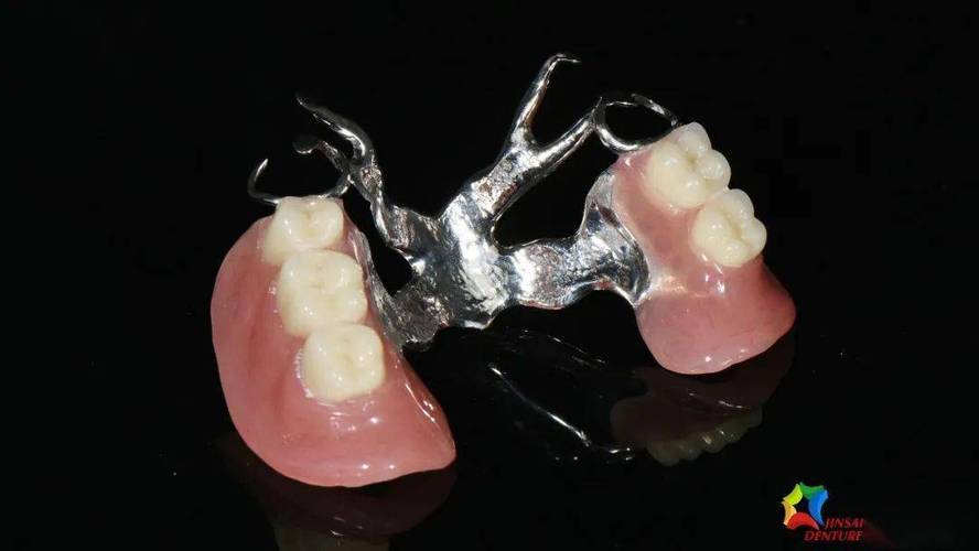 维他灵支架-应力中断的概念与原理