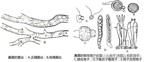 真菌的菌丝及有性孢子类型