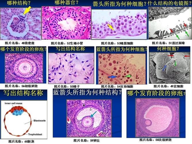 组胚实验考试图
