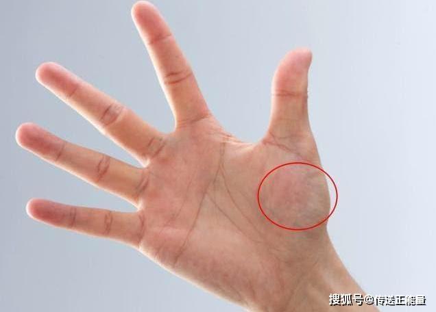 手若这有4种"表现",或是"肠癌"已报道