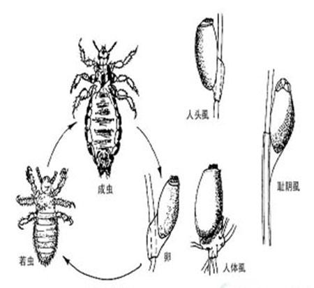 患上阴虱病的原因是什么