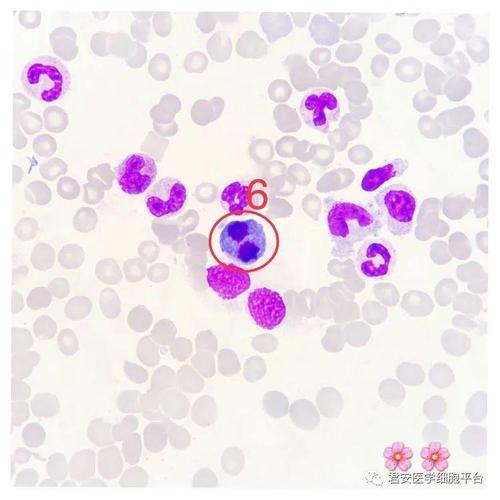 看图识细胞(第78期)_胞核