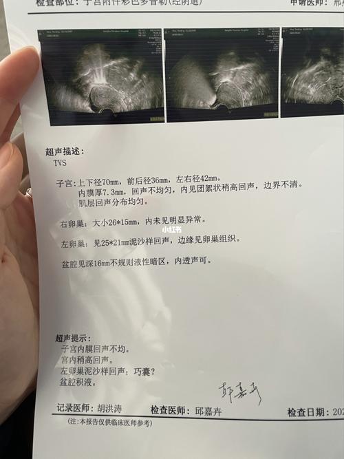 不想做宫腔镜检查…_子宫_月经_子宫内膜息肉_医疗健康_医疗健康其他