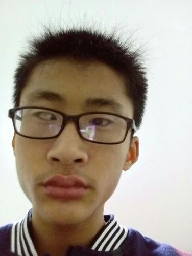 做斗鸡眼为什么有一只斜的有一只正的