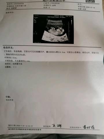 我怀孕11周内见孕囊头臂长约是男孩还是女孩