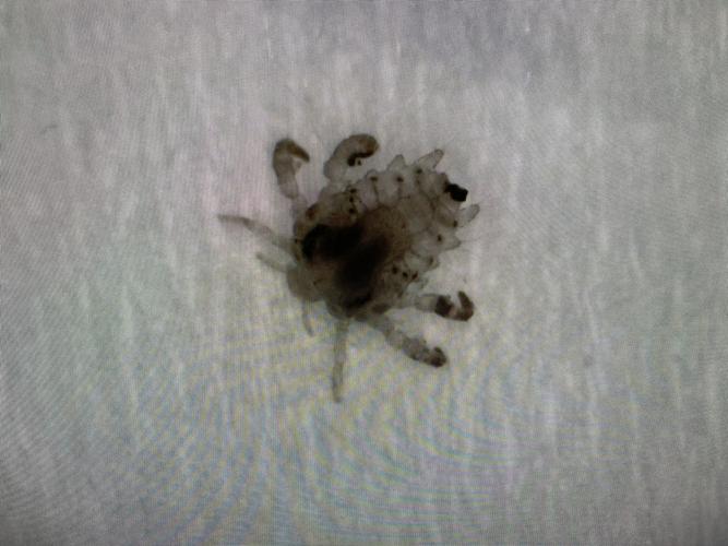 为什么毛发处晚上剧烈瘙痒可能是得了虱病