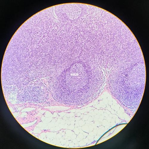 组胚绘图-淋巴结_组织学与胚胎学实验绘图_人文_绘画