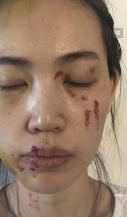 额头部分的血迹已经凝成块状,太阳穴部分青中泛黄,看来下手不轻.