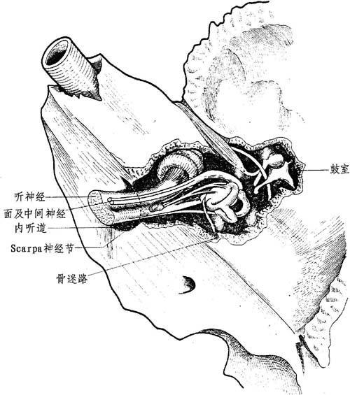 图11-3 内听道里听神经