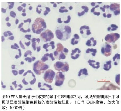 一般会在嗜酸性肉芽肿,过敏性皮肤病,寄生虫移行,肥大细胞瘤, 真菌
