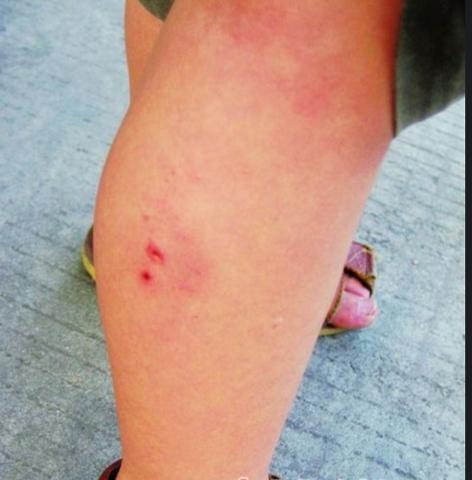 求小狗咬伤人图片