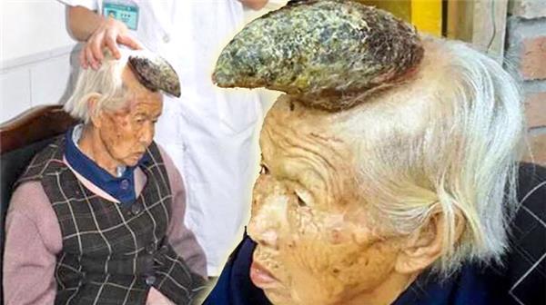 5个头上长角的人,中国占了3个