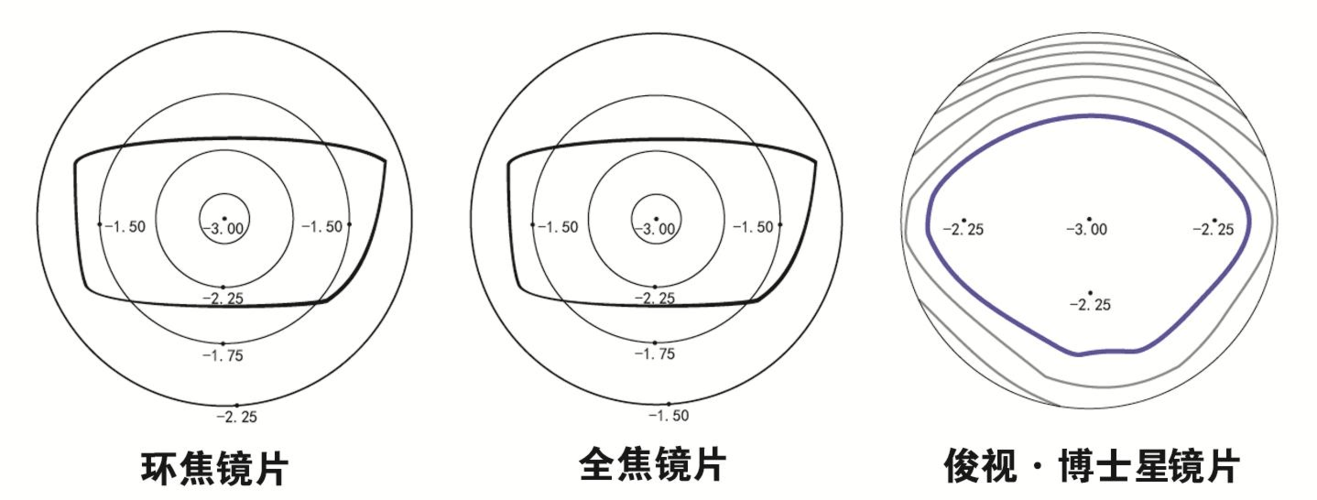 离焦,全焦,环焦镜片的区别