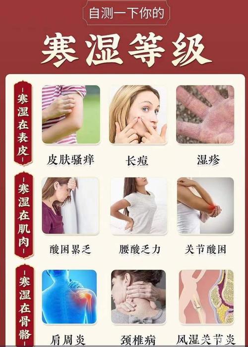 养生之道,身体湿气重的一些表现症状