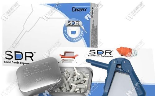 瑞典sdr纳米树脂补牙价格来咯,登士柏优缺点也都有哈