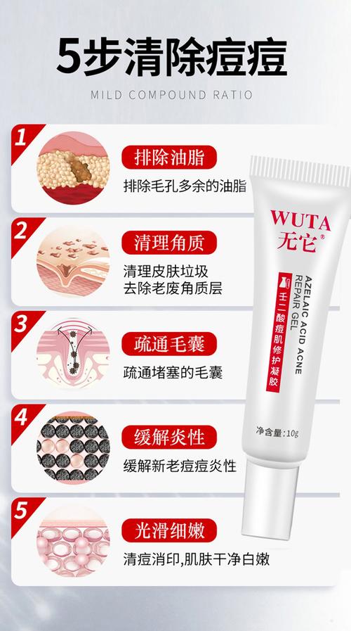 15%壬二酸凝胶乳膏壬二酸痘肌修护凝胶壬二酸凝胶祛痘