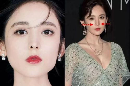 娜扎的鼻子在整体五官中属于孤立的存在,既不能呼应眼型的媚态,也不