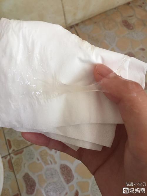 这种白带正常吗排卵期曾多[生病]