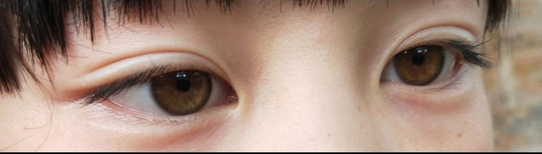 我的一个小侄女,眼睛是浅褐色的(其实虹膜边缘还带一点绿,我没给拍出