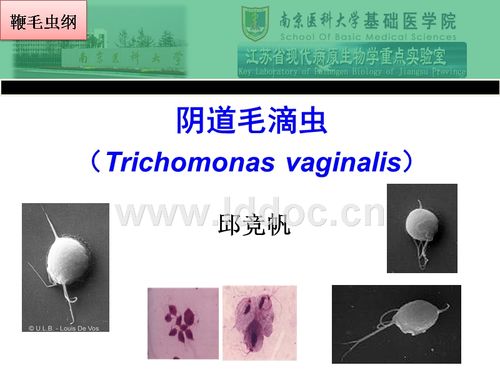 ppt   邱竞帆 阴道毛滴虫 trichomonasvaginalis 鞭毛虫纲 简介 寄生