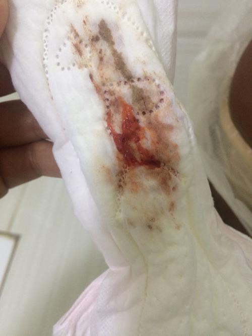 这几个月月经量少,头半天颜色正常.